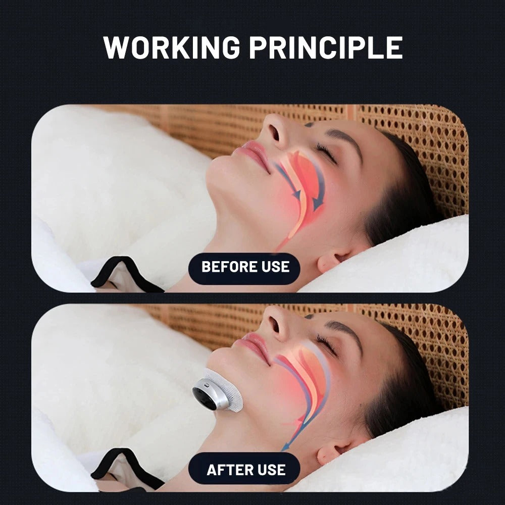 Dispositif anti-ronflement Nuvella™ – Sommeil calme et réparateur
