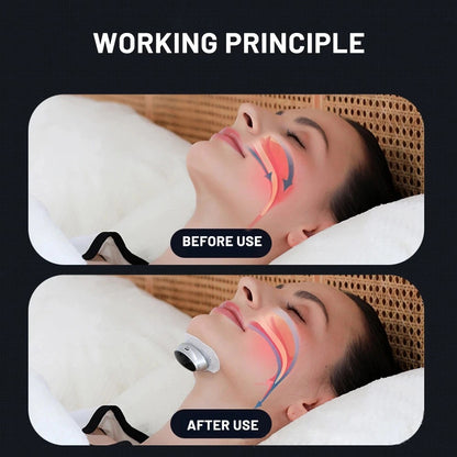 Dispositif anti-ronflement Nuvella™ – Sommeil calme et réparateur